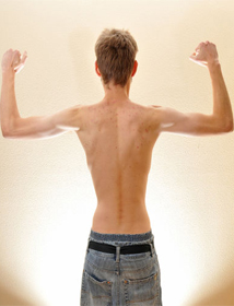 underweight2 underweight2