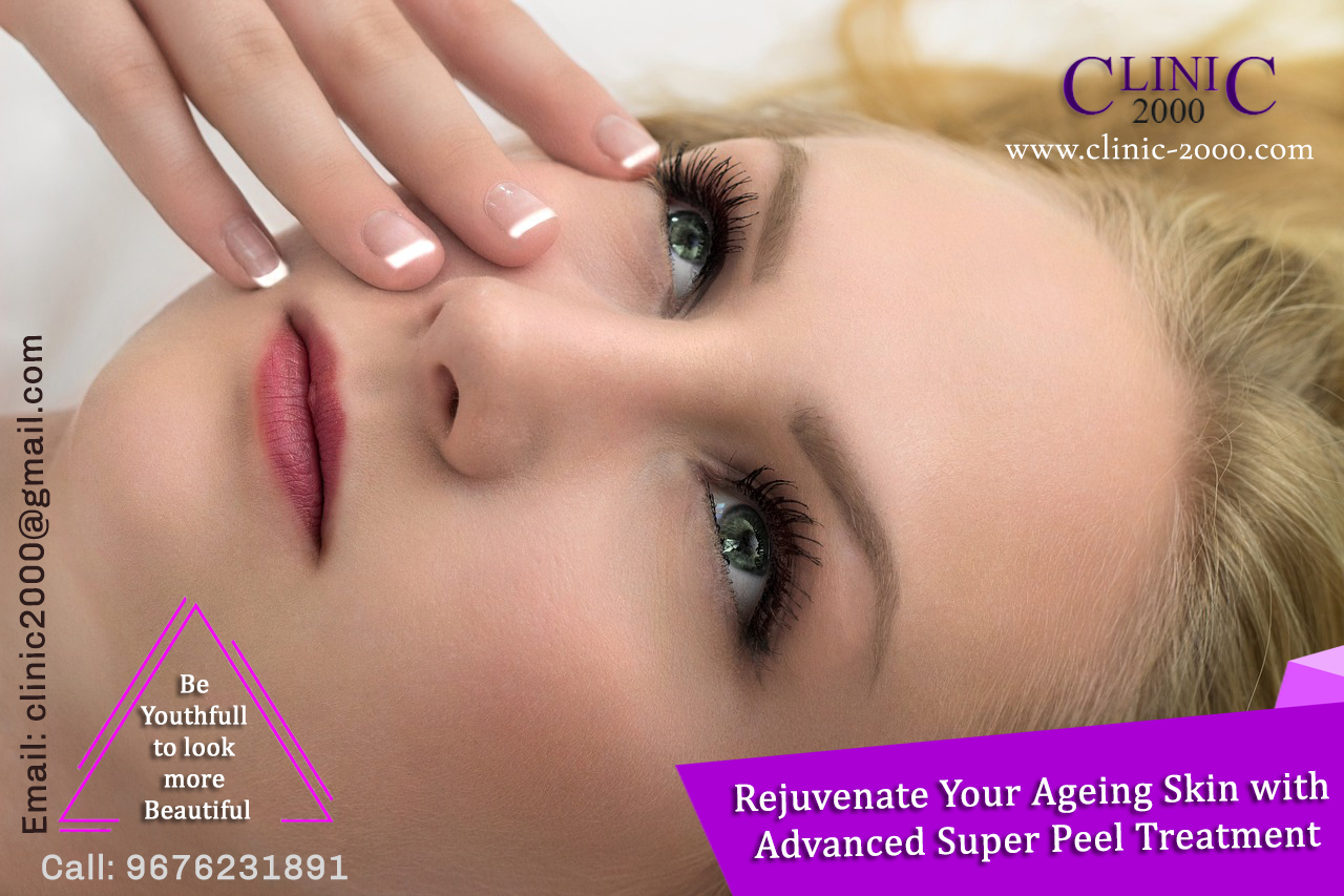 Rejuvenate Your Ageing Skin with Advanced Super Peel Treatment