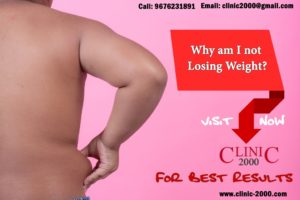 Top Weight Loss Clinic in Hyderabad