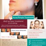 Acne Pimples Scar Treatment