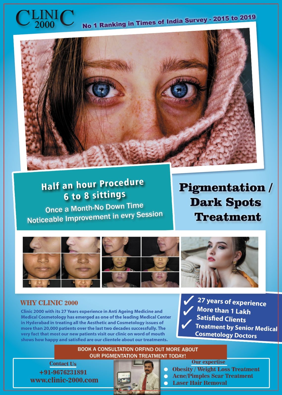 Pigmentation Treatment In Hyderabad Pigmentation Treatment - Clinic 2000