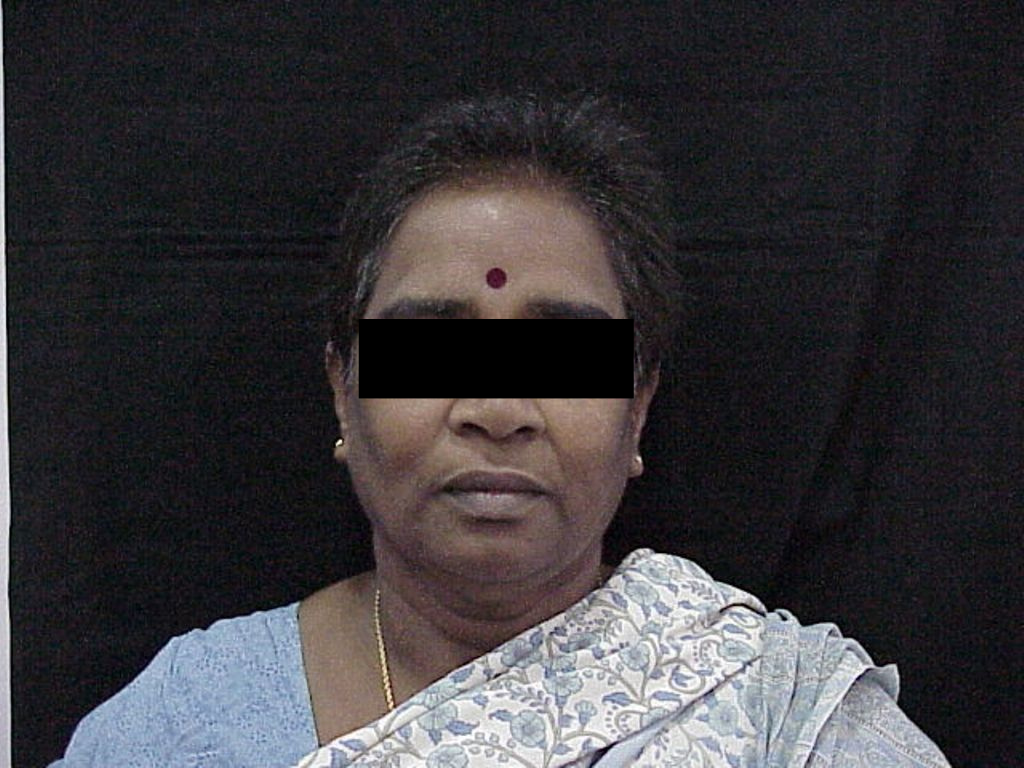 102