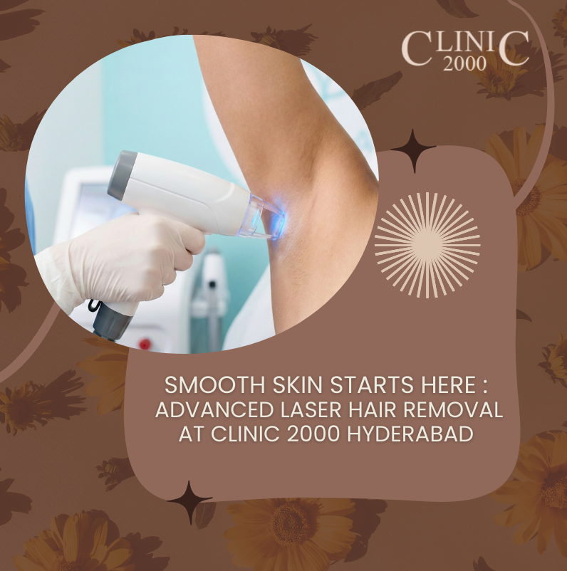 Permanent Laser Hair Removal in Hyderabad – The Complete Guide for Smooth, Hair-Free Skin