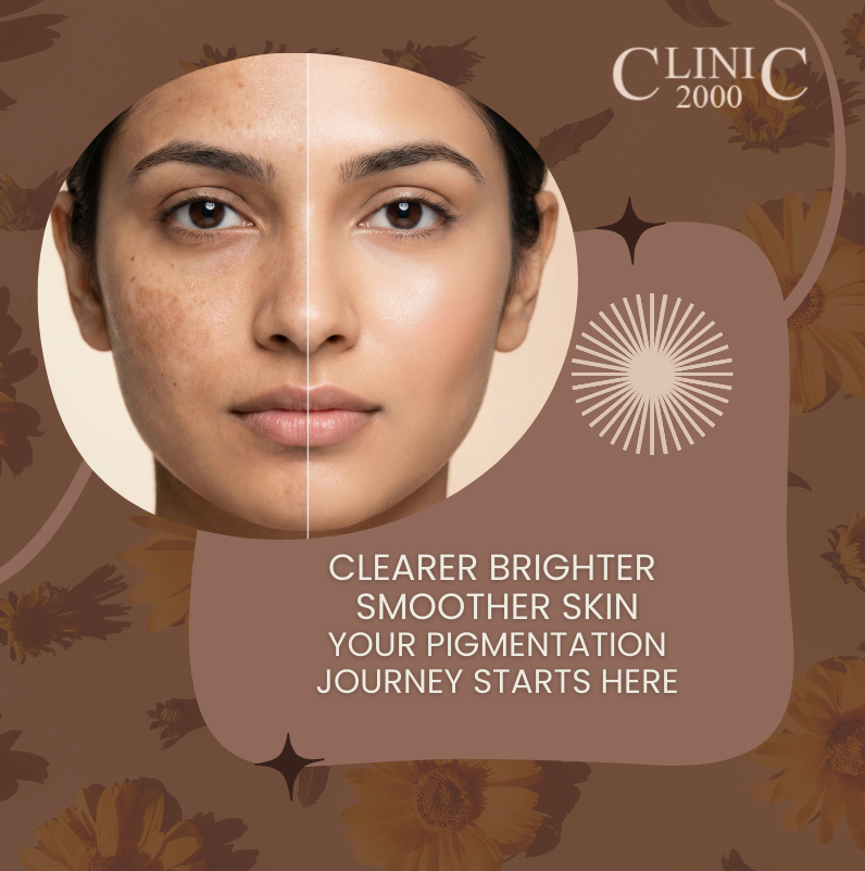 Pigmentation Treatment in Hyderabad Your Complete Guide to Clear Brighter Skin at Clinic 2000