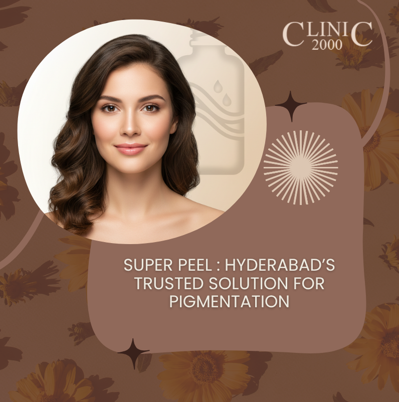 12 Powerful Facts About Pigmentation and the Best Treatment in Hyderabad (Super Peel at Clinic 2000)