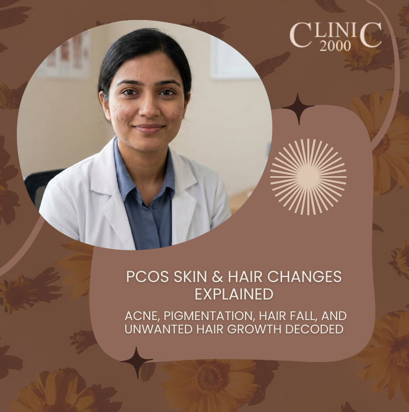 PCOS Skin and Hair Changes Explained | Acne, Pigmentation & Hair Growth – Clinic 2000
