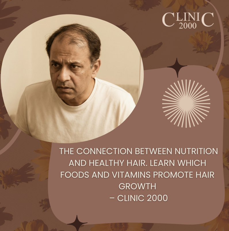 The Role of Nutrition in Hair Health | How Your Diet Impacts Hair Growth | Clinic 2000