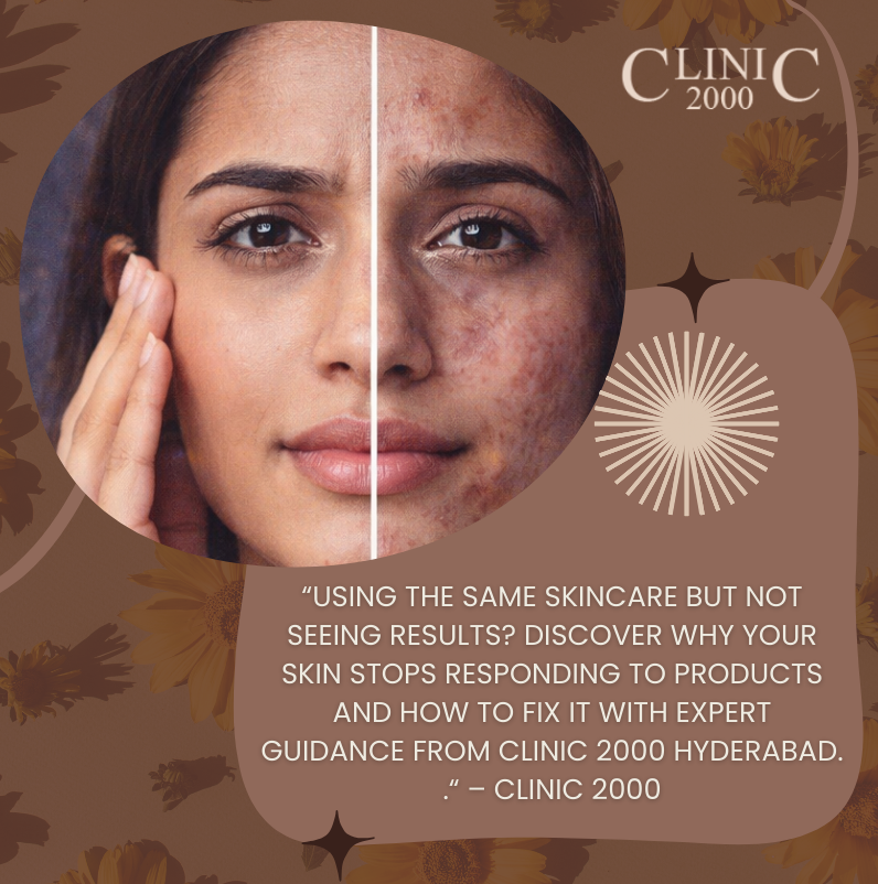 Why Your Skincare Isn’t Working Anymore | Skin Not Improving? | Clinic 2000