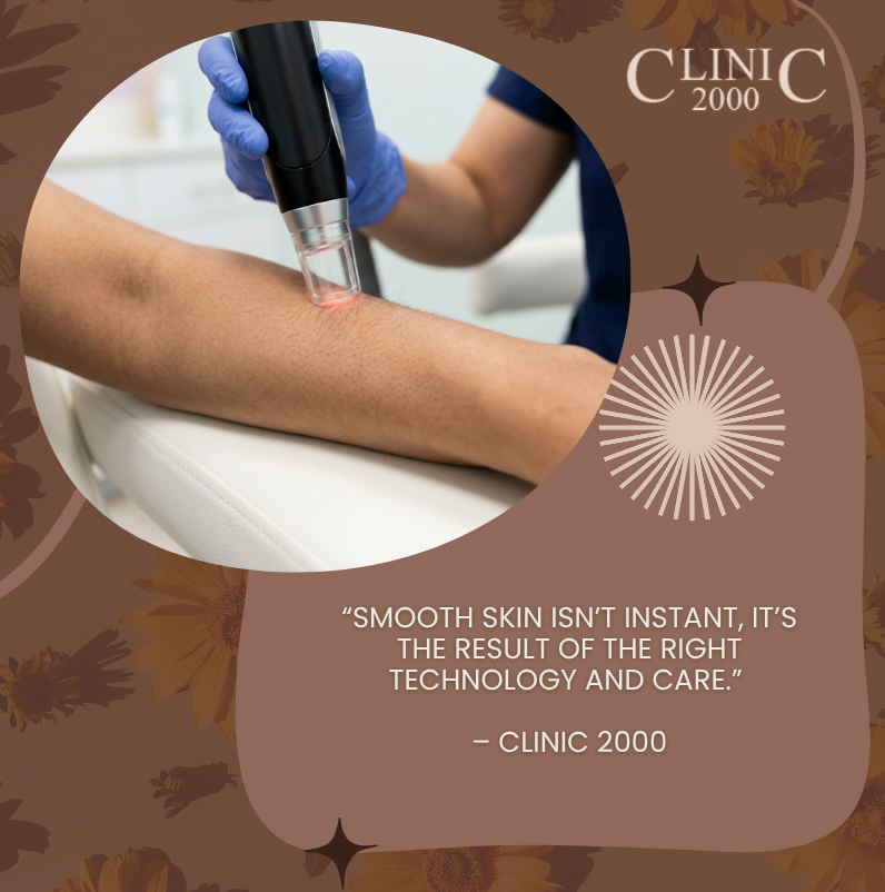 Is Laser Hair Removal Really Permanent? The Complete Guide