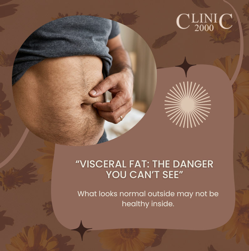 Visceral Fat: The Hidden Danger Inside Your Body