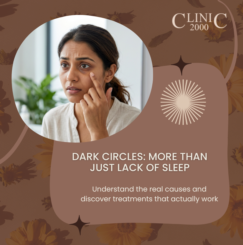 Dark Circles Under Eyes: Real Causes & Treatments That Work